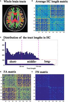 The different damage patterns of short-, middle- and long-range connections between patients with relapse-remitting multiple sclerosis and neuromyelitis optica spectrum disorder